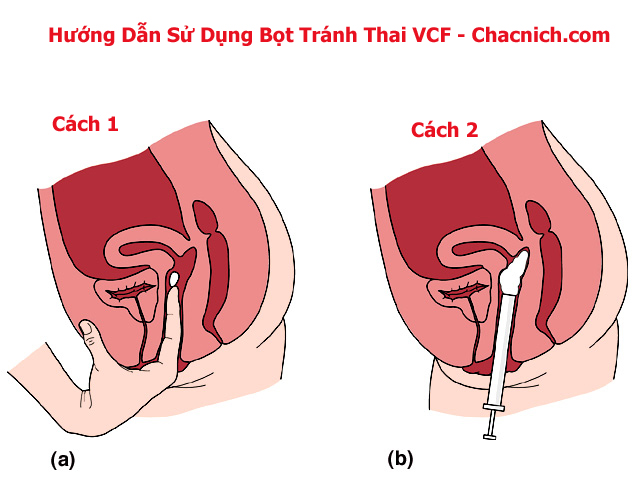 Đại lý Gel tránh thai VCF vaginal contraceptive quan hệ không cần dùng bao cao su  hàng xách tay